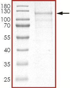 EGFR (d746-750), Active with mCherry